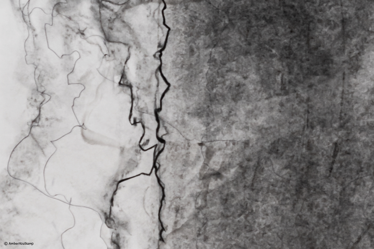 d003_03_B85_1453_d2_w